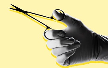 vasectomy linked to cancer