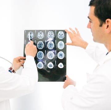 Doctors Consult Over An MRI Scan Of The Brain Doctors Consult Over An MRI Scan Of The Brain
